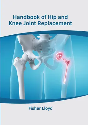 Príručka o náhrade bedrového a kolenného kĺbu - Handbook of Hip and Knee Joint Replacement