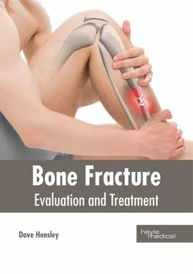 Zlomenina kosti: Hodnotenie a liečba - Bone Fracture: Evaluation and Treatment