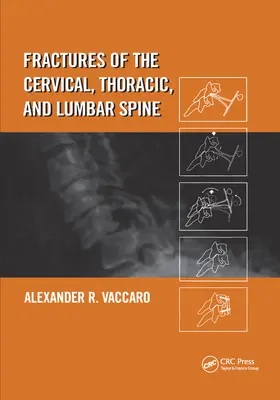 Zlomeniny krčnej, hrudnej a bedrovej chrbtice - Fractures of the Cervical, Thoracic, and Lumbar Spine