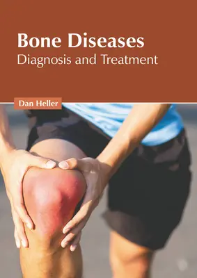 Choroby kostí: Diagnostika a liečba - Bone Diseases: Diagnosis and Treatment