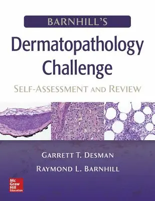 Barnhillova dermatopatologická výzva: Sebahodnotenie a prehľad - Barnhill's Dermatopathology Challenge: Self-Assessment & Review