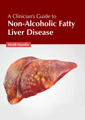 Sprievodca lekára nealkoholovou tukovou chorobou pečene - A Clinician's Guide to Non-Alcoholic Fatty Liver Disease