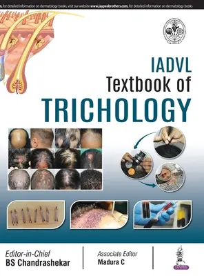 IADVL Učebnica trichológie - IADVL Textbook of Trichology