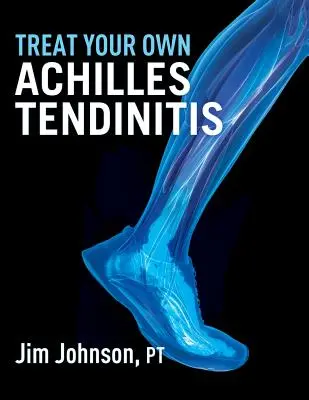 Liečba vlastnej Achillovej šľachy - Treat Your Own Achilles Tendinitis