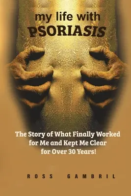 Môj život s PSORIÁZOU: Príbeh o tom, čo u mňa konečne zabralo a udržalo ma čistého viac ako 30 rokov! - my life with PSORIASIS: The story of what finally worked for me and kept me clear for over 30 years!