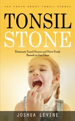 Tonsilové kamene: (Odstráňte mandľové kamene a majte svieži dych už za niekoľko dní!) - Tonsil Stones: The Truth about Tonsil Stones (Eliminate Tonsil Stones and Have Fresh Breath in Just Days!)