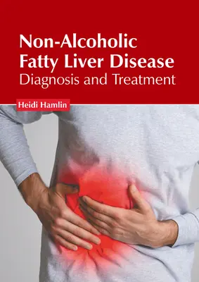 Nealkoholická tuková choroba pečene: Diagnostika a liečba - Non-Alcoholic Fatty Liver Disease: Diagnosis and Treatment