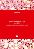Transplantácia pečene: Základné otázky - Liver Transplantation: Basic Issues