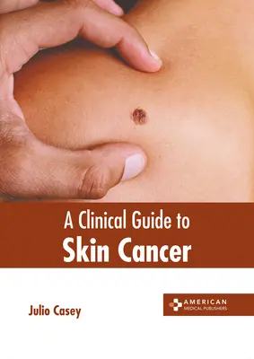 Klinický sprievodca rakovinou kože - A Clinical Guide to Skin Cancer