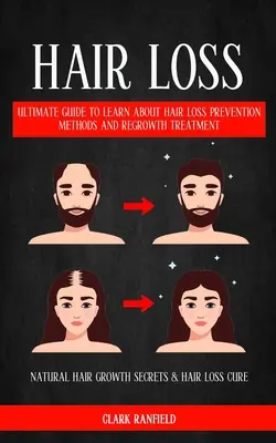 Vypadávanie vlasov: Ultimate Guide To Learn About Hair Loss Prevention Methods And Regrowth Treatment (Natural Hair Growth Secrets & Hair - Hair Loss: Ultimate Guide To Learn About Hair Loss Prevention Methods And Regrowth Treatment (Natural Hair Growth Secrets & Hair