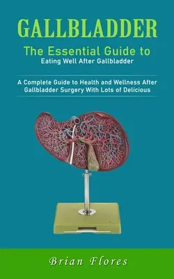 Žlčník: (Kompletný sprievodca zdravím a pohodou po operácii žlčníka): Základný sprievodca dobrým stravovaním po operácii žlčníka - Gallbladder: The Essential Guide to Eating Well After Gallbladder (A Complete Guide to Health and Wellness After Gallbladder Surger
