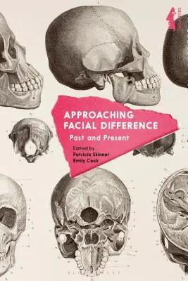 Priblíženie tvárovej odlišnosti: Minulosť a súčasnosť - Approaching Facial Difference: Past and Present