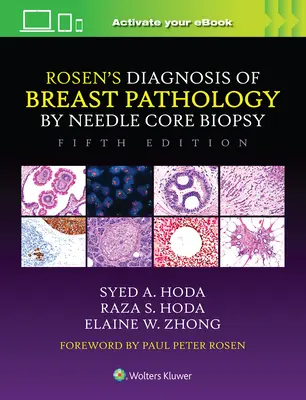 Rosenova diagnostika patológie prsníka pomocou ihlovej jadrovej biopsie - Rosen's Diagnosis of Breast Pathology by Needle Core Biopsy