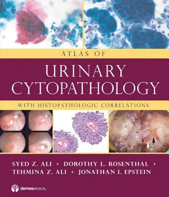 Atlas močovej cytopatológie: S histopatologickými koreláciami - Atlas of Urinary Cytopathology: With Histopathologic Correlations