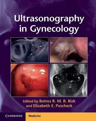 Ultrasonografia v gynekológii - Ultrasonography in Gynecology