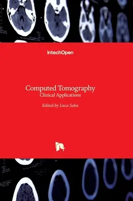 Počítačová tomografia: Klinické aplikácie - Computed Tomography: Clinical Applications