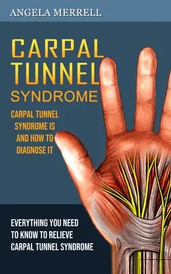 Syndróm karpálneho tunela: Syndróm karpálneho tunela je a ako ho diagnostikovať - Carpal Tunnel Syndrome: Carpal Tunnel Syndrome is and How to Diagnose It