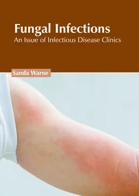 Hubové infekcie: Vydanie časopisu Infectious Disease Clinics - Fungal Infections: An Issue of Infectious Disease Clinics