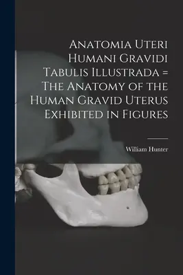 Anatomia Uteri Humani Gravidi Tabulis Illustrada = Anatómia ľudskej gravidnej maternice zobrazená na obrázkoch - Anatomia Uteri Humani Gravidi Tabulis Illustrada = The Anatomy of the Human Gravid Uterus Exhibited in Figures