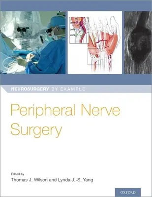 Chirurgia periférnych nervov - Peripheral Nerve Surgery