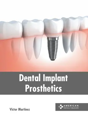 Zubné implantáty - Dental Implant Prosthetics