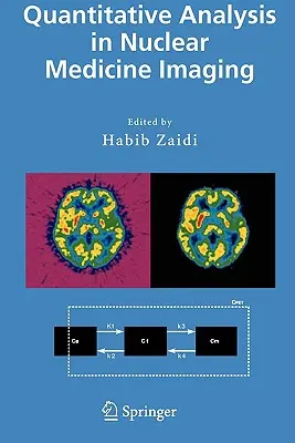 Kvantitatívna analýza v zobrazovaní v nukleárnej medicíne - Quantitative Analysis in Nuclear Medicine Imaging