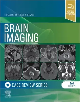 Prehľad prípadov zobrazovania mozgu - Brain Imaging Case Review