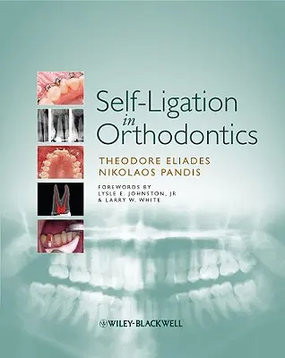 Self-Ligation in Orthodontics (Samostatná ligácia v ortodoncii): Prístup k biomechanike a liečbe založený na dôkazoch - Self-Ligation in Orthodontics: An Evidence-Based Approach to Biomechanics and Treatment