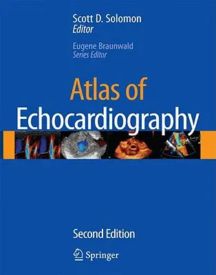 Atlas echokardiografie [s CDROM] - Atlas of Echocardiography [With CDROM]