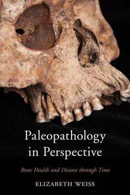 Paleopatológia v perspektíve: Zdravie a choroby kostí v priebehu času - Paleopathology in Perspective: Bone Health and Disease through Time