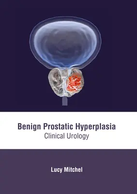 Benigná hyperplázia prostaty: klinická urológia - Benign Prostatic Hyperplasia: Clinical Urology