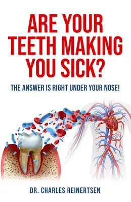 Sú vaše zuby príčinou vašej choroby?: Odpoveď máte priamo pod nosom - Are Your Teeth Making You Sick?: The Answer Is Right Under Your Nose