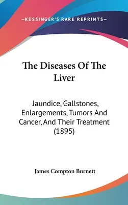 Choroby pečene: Žltačka, žlčové kamene, zväčšenie, nádory a rakovina a ich liečba (1895) - The Diseases Of The Liver: Jaundice, Gallstones, Enlargements, Tumors And Cancer, And Their Treatment (1895)