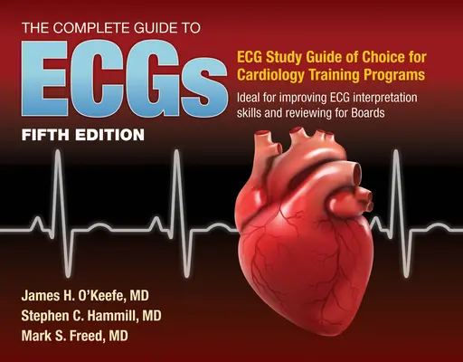 Kompletný sprievodca ekg: Komplexná študijná príručka na zlepšenie zručností pri interpretácii EKG: Komplexná študijná príručka na zlepšenie schopností interpretácie EKG: A Comprehensive Study Guide to Improve ECG Interpretatio - The Complete Guide to Ecgs: A Comprehensive Study Guide to Improve ECG Interpretation Skills: A Comprehensive Study Guide to Improve ECG Interpretatio