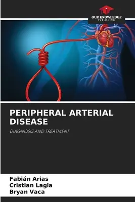 Periférne artériové ochorenie - Peripheral Arterial Disease