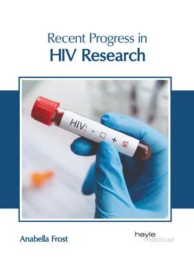 Nedávny pokrok vo výskume HIV - Recent Progress in HIV Research