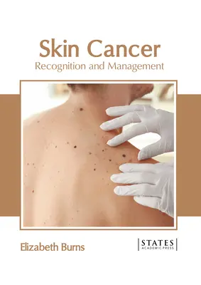 Rakovina kože: Rozpoznanie a liečba - Skin Cancer: Recognition and Management