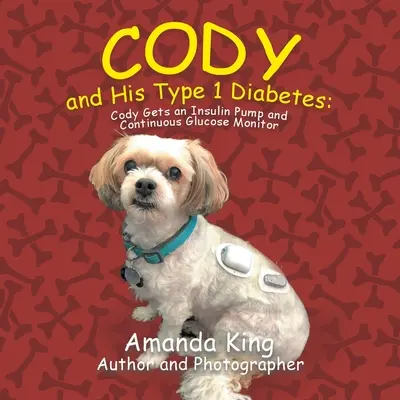 Cody a jeho diabetes 1. typu: Cody dostane inzulínovú pumpu a kontinuálny monitor glukózy - Cody and His Type 1 Diabetes: Cody Gets an Insulin Pump and Continuous Glucose Monitor