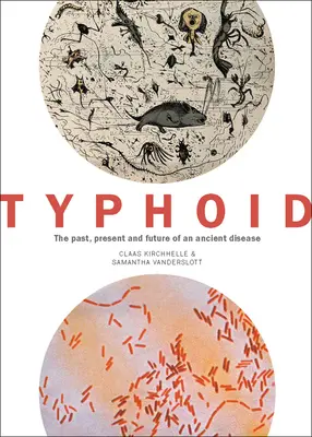 Brušný týfus: Minulosť, súčasnosť a budúcnosť starobylej choroby - Typhoid: The Past, Present, and Future of an Ancient Disease