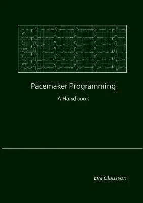 Programovanie kardiostimulátora: Príručka - Pacemaker Programming: A Handbook