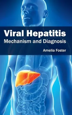 Vírusová hepatitída: Vírusová hepatitída: mechanizmus a diagnostika - Viral Hepatitis: Mechanism and Diagnosis