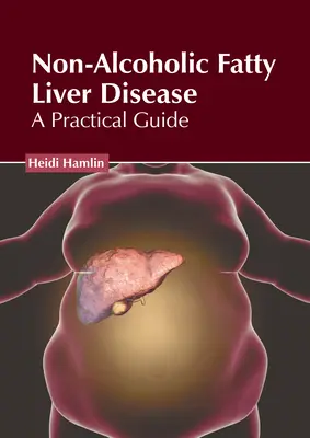 Nealkoholová tuková choroba pečene: Praktická príručka - Non-Alcoholic Fatty Liver Disease: A Practical Guide