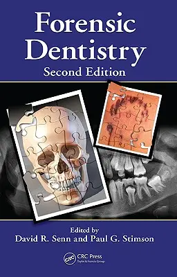 Súdne zubné lekárstvo - Forensic Dentistry