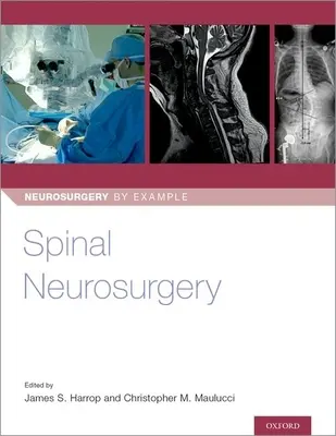 Spinálna neurochirurgia - Spinal Neurosurgery