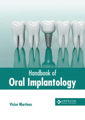 Príručka ústnej implantológie - Handbook of Oral Implantology