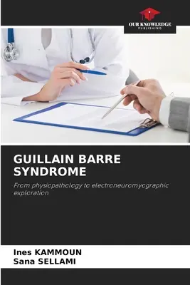 Syndróm Guillain Barre - Guillain Barre Syndrome
