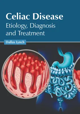 Celiakia: Etiológia, diagnostika a liečba - Celiac Disease: Etiology, Diagnosis and Treatment