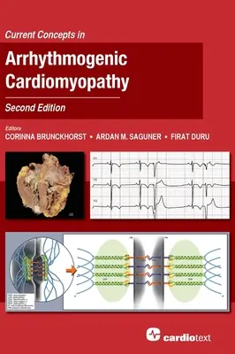 Súčasné koncepcie arytmogénnej kardiomyopatie, druhé vydanie - Current Concepts in Arrhythmogenic Cardiomyopathy, Second Edition
