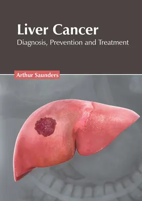 Rakovina pečene: Diagnostika, prevencia a liečba - Liver Cancer: Diagnosis, Prevention and Treatment