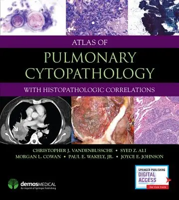 Atlas cytopatológie pľúc - Atlas of Pulmonary Cytopathology